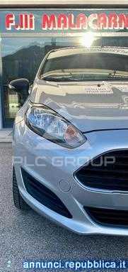 2015 Ford FIESTA