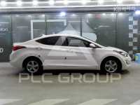 2015 Hyundai Avante