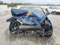 2016 Hyundai Elantra photo