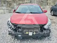 2017 Hyundai Accent photo