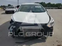 2017 Hyundai Accent photo