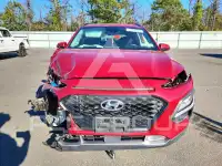 2018 Hyundai Kona фото