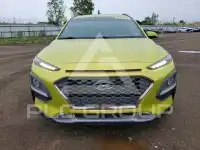 2018 Hyundai Kona фото