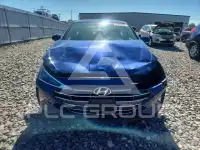 2020 Hyundai Elantra фото