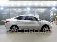 2015 Hyundai Accent