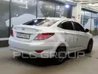 2017 Hyundai Accent