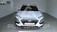 2017 Hyundai Kona