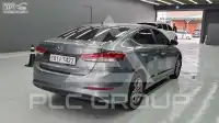 2017 Hyundai Avante