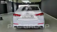 2017 Hyundai Avante