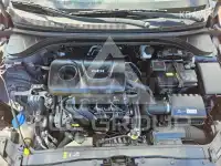 2017 Hyundai Avante