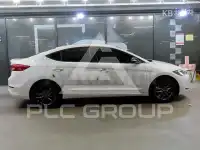 2017 Hyundai Avante