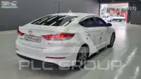 2017 Hyundai Avante