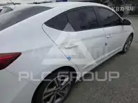 2017 Hyundai Avante
