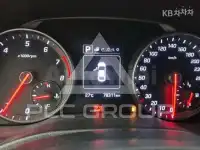 2017 Hyundai Avante