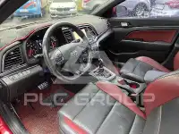 2017 Hyundai Avante