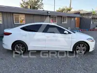 2017 Hyundai Avante