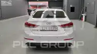 2018 Hyundai Avante