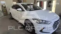 2018 Hyundai Avante