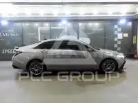 2022 Hyundai Avante