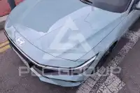 2025 Hyundai Avante