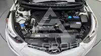 2014 Hyundai Avante