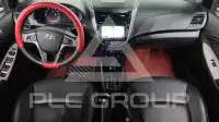2016 Hyundai Accent