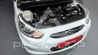 2016 Hyundai Accent