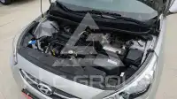 2017 Hyundai Accent