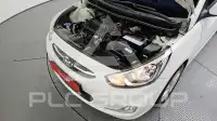 2017 Hyundai Accent