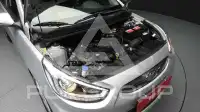 2017 Hyundai Accent