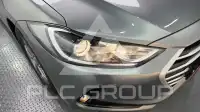2017 Hyundai Avante