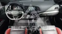 2017 Hyundai Avante