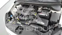 2017 Hyundai Avante