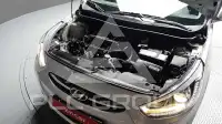 2017 Hyundai Accent