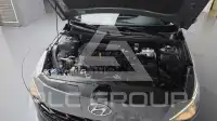 2022 Hyundai Avante