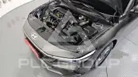 2024 Hyundai Avante