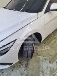 2024 Hyundai Avante