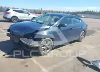 2017 Hyundai Elantra фото
