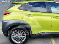 2018 Hyundai Kona