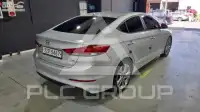 2017 Hyundai Avante