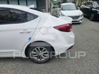 2018 Hyundai Avante