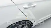 2017 Hyundai Avante