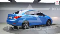 2018 Hyundai Accent