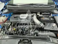 2017 Hyundai Avante