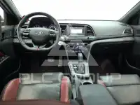 2017 Hyundai Avante