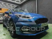 2018 Ford FIESTA