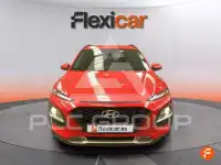 2018 Hyundai Kona